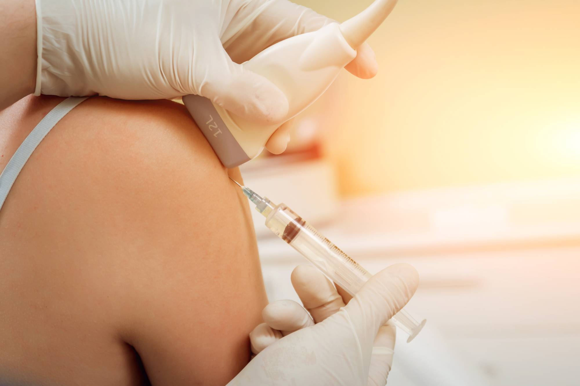 Ultrasound guided Joint and Soft Tissue injections